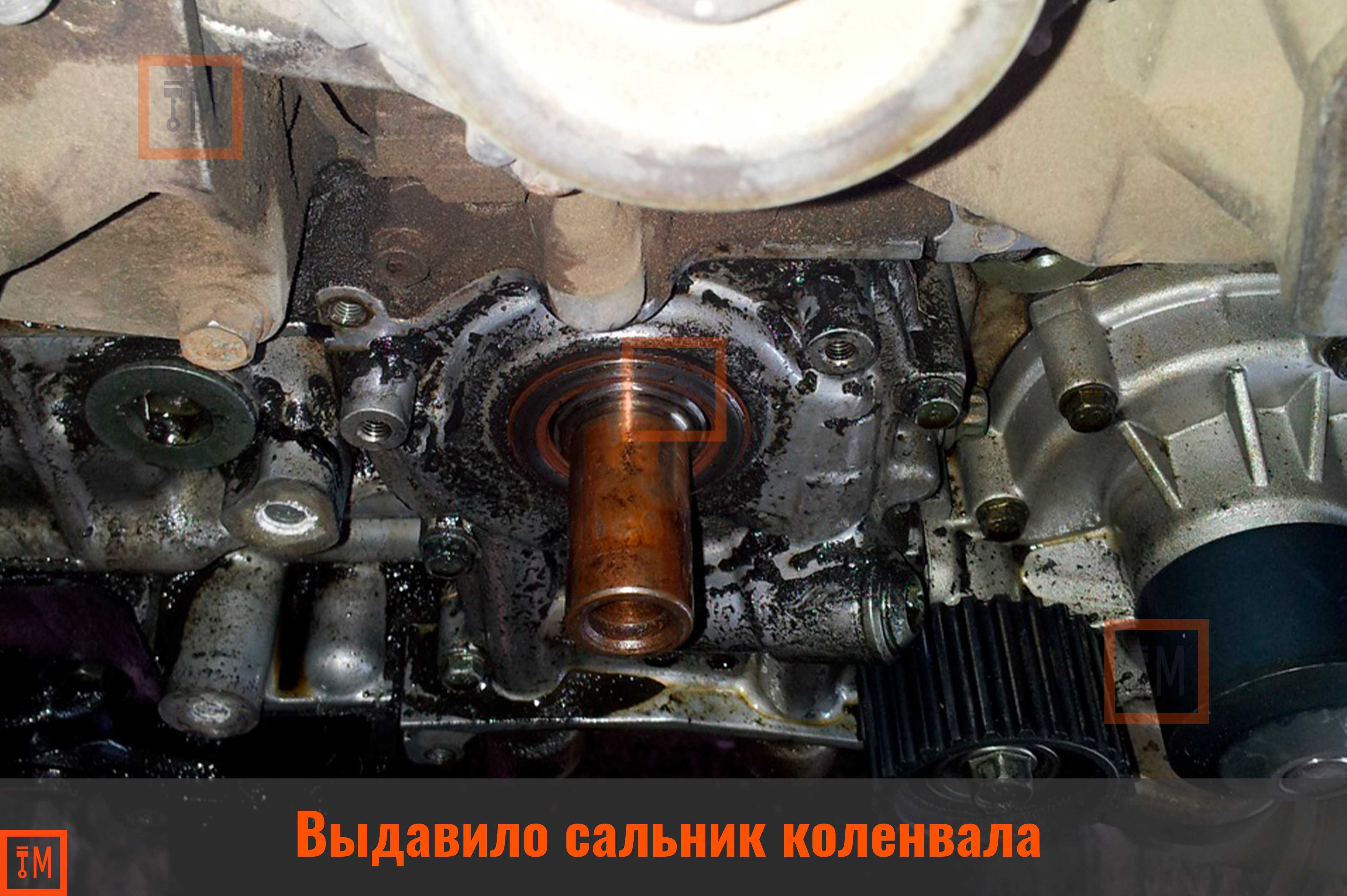 Причины выдавливания сальника: осевой люфт, густое масло, неправильно установлен, забита система вентиляции картерных газов, перелив уровня и другие причины