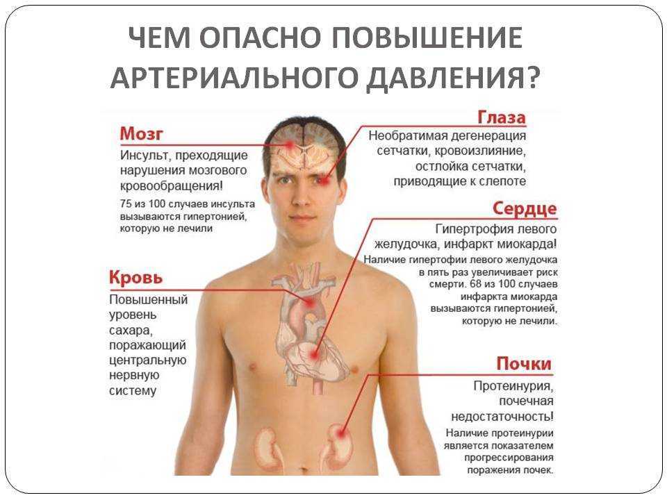 Люди гипотоники: кто это, с каким давлением живут, рекомендации по образу жизни